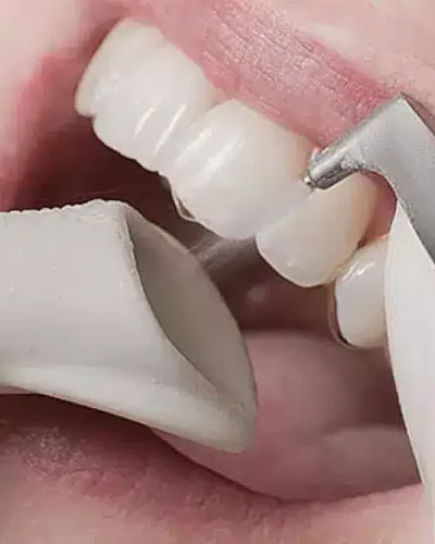 air-flow-toothpolish